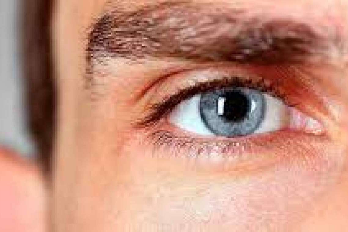 El glaucoma es la segunda causa de ceguera en Occidente