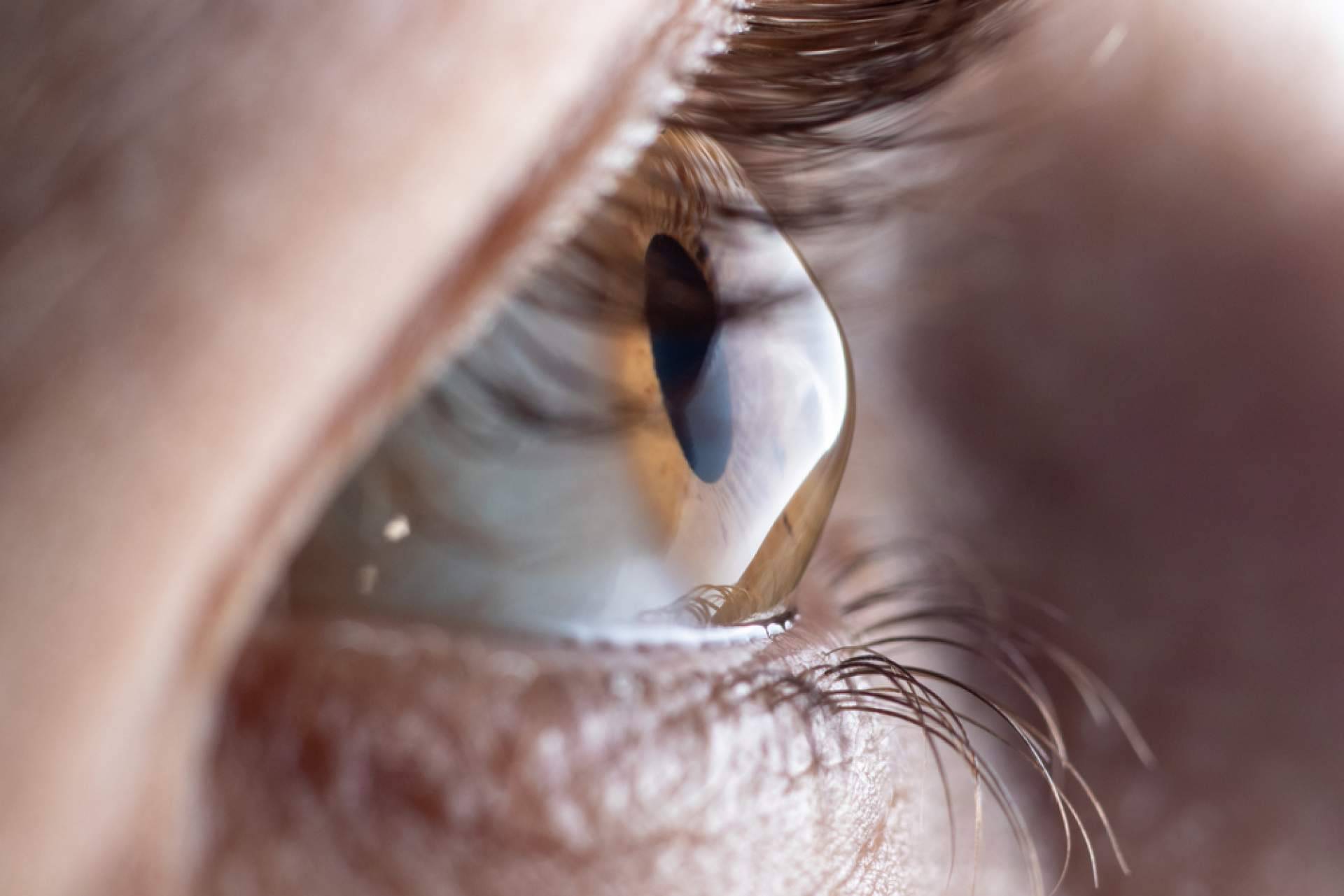 Departamento de Oftalmología del Instituto Universitario Dexeus ofrece la posibilidad de eliminar de forma definitiva el uso de gafas o lentillas