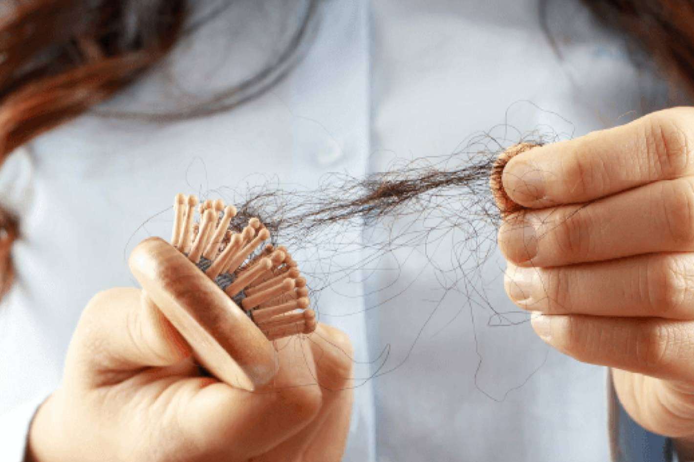 ¿El pelo puede caerse por estrés?