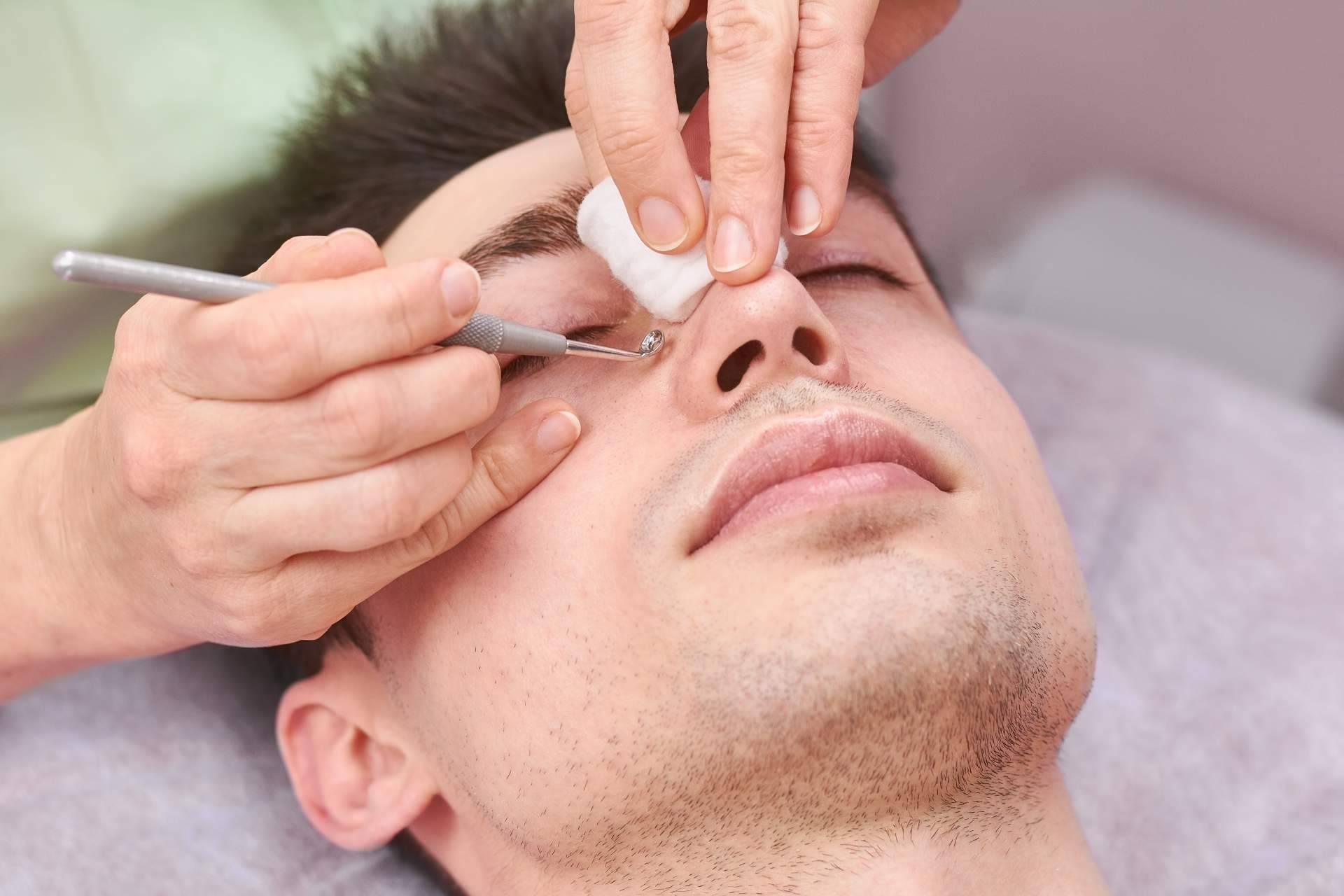 Los tratamientos de higiene facial masculina disponibles en Malecare