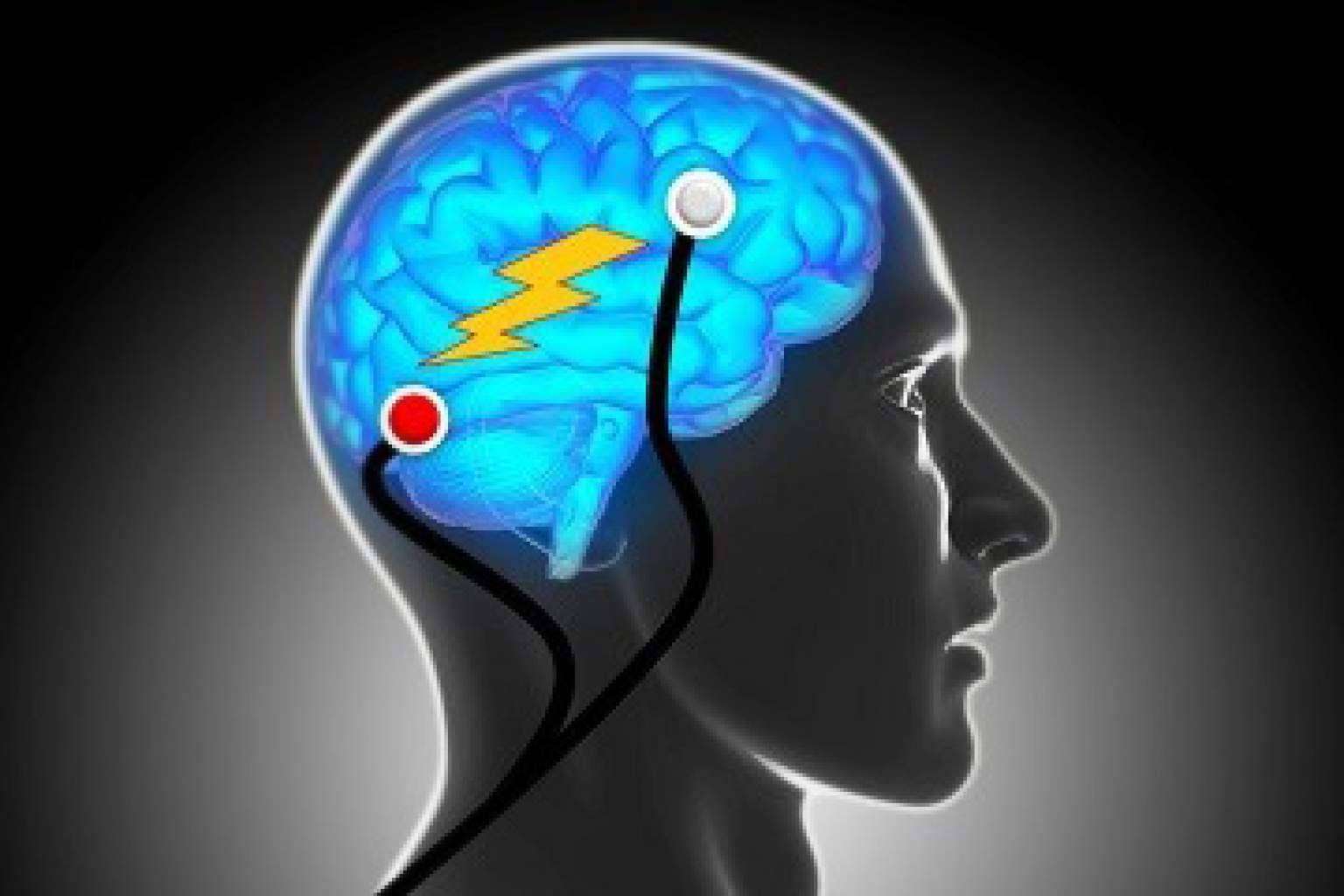 Estimulación magnética transcraneal