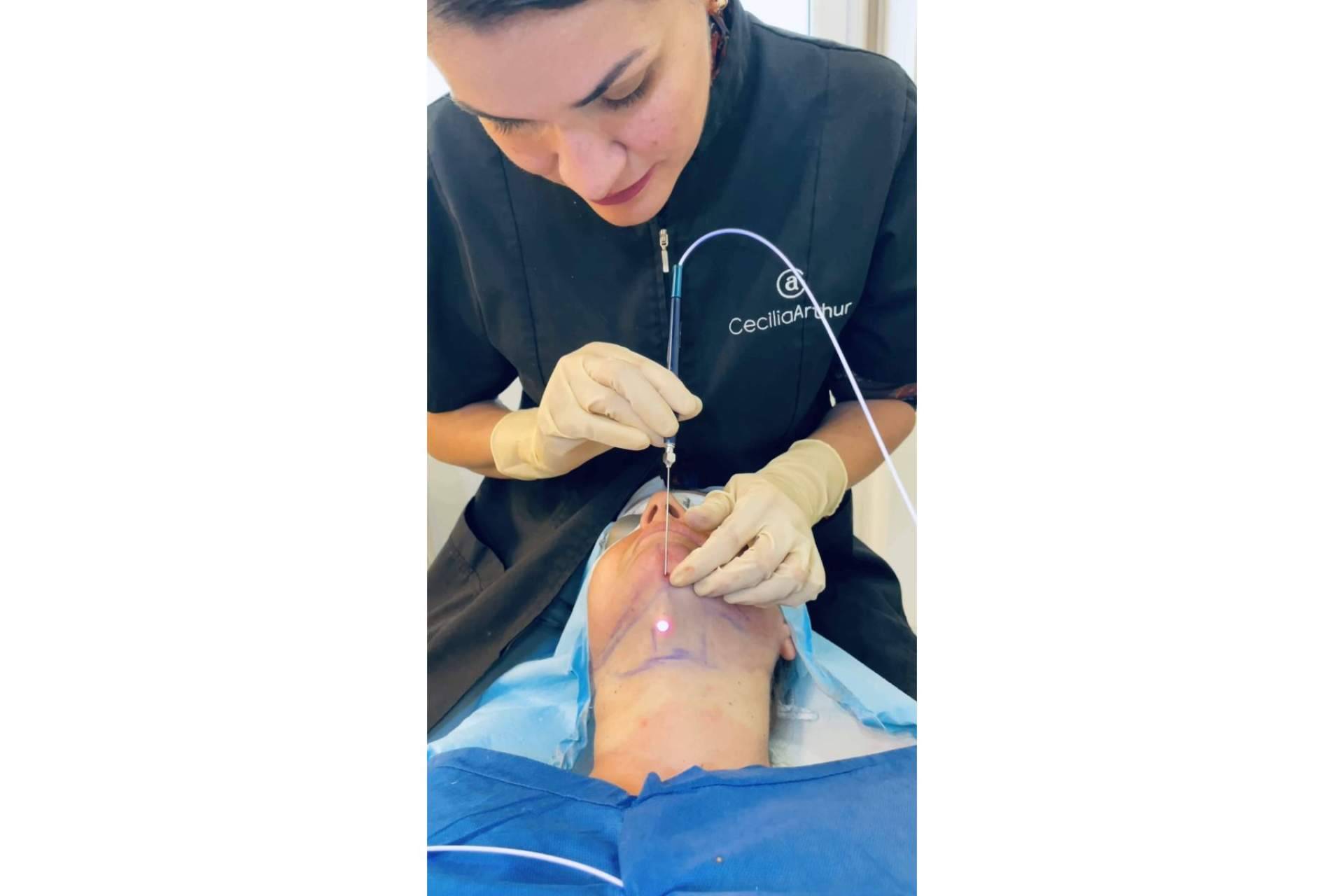 La Dra. Cecilia Arthur describe los beneficios del tensado de cuello con Klaser Blue