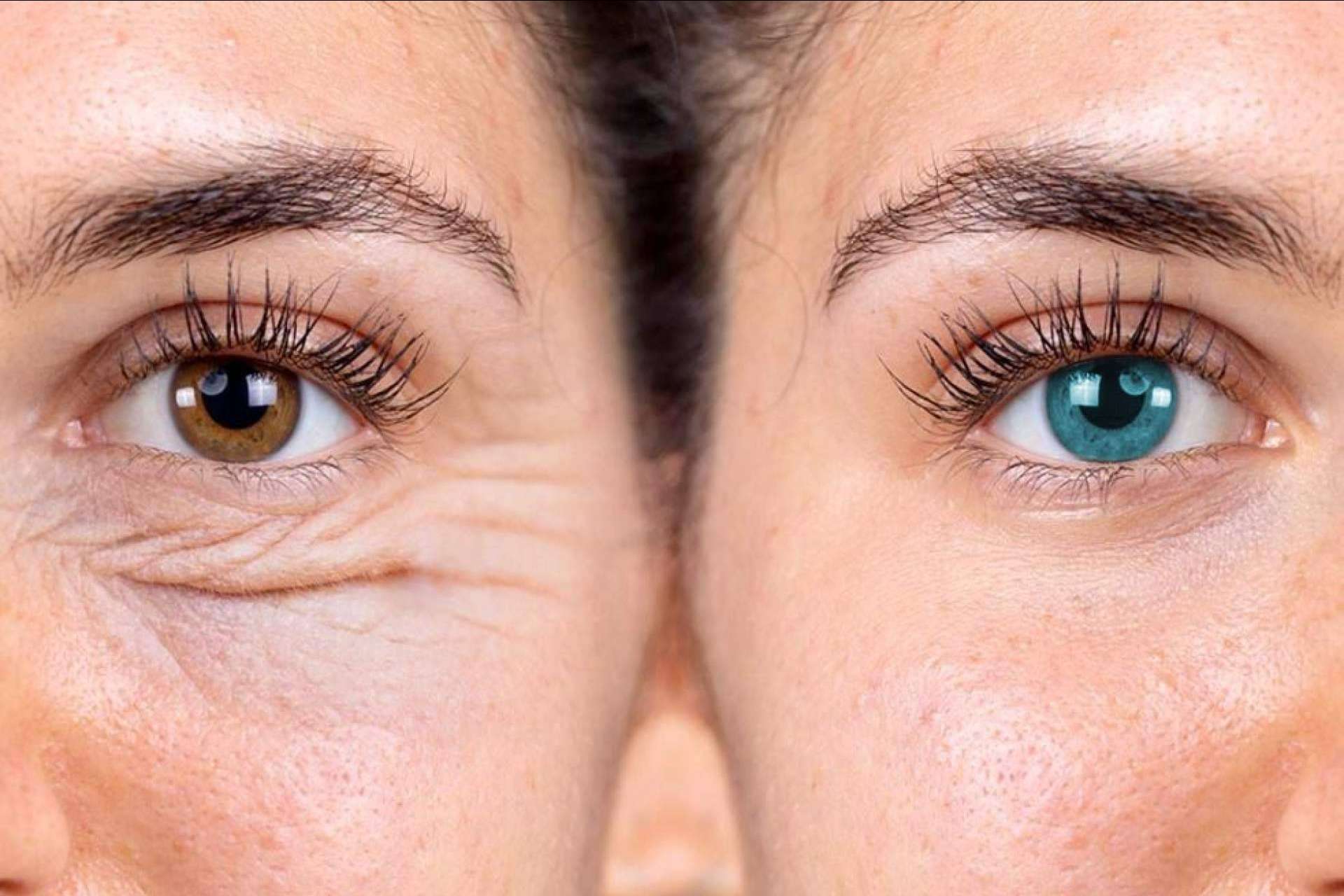 El cambio total facial es posible (ojos y párpados)