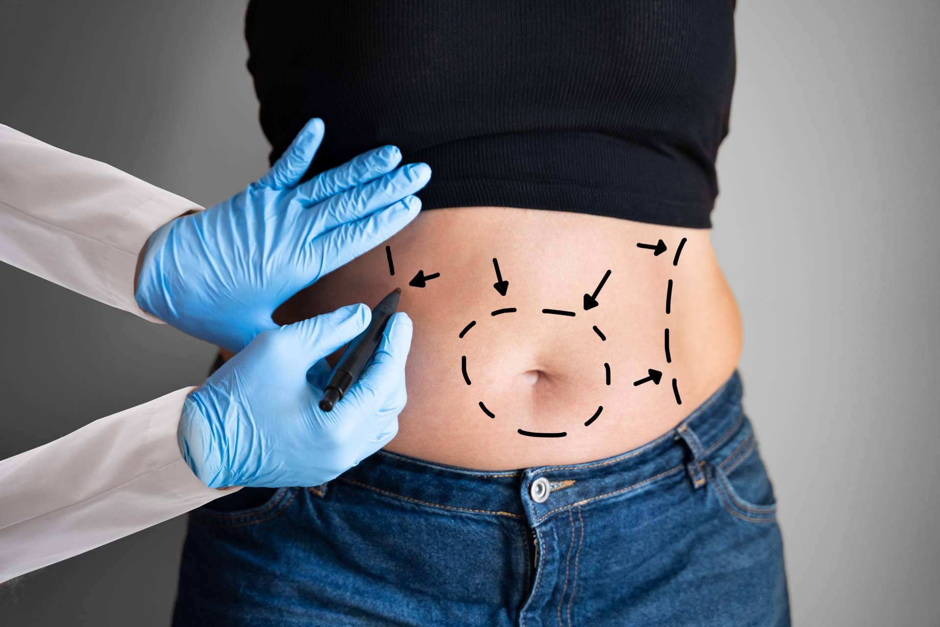 Beauty&Beauty, clínica especializada en abdominoplastia y dermolipectomia en España