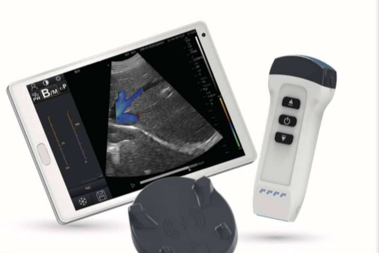 SCPmedical fortalece su catálogo con la línea completa de ecógrafos inalámbricos y portátiles Dawei