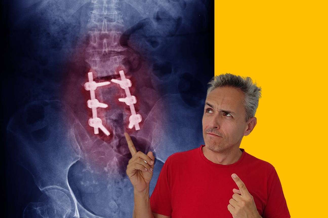 Estrategias de entrenamiento para estenosis del canal medular según Roberto Galván
