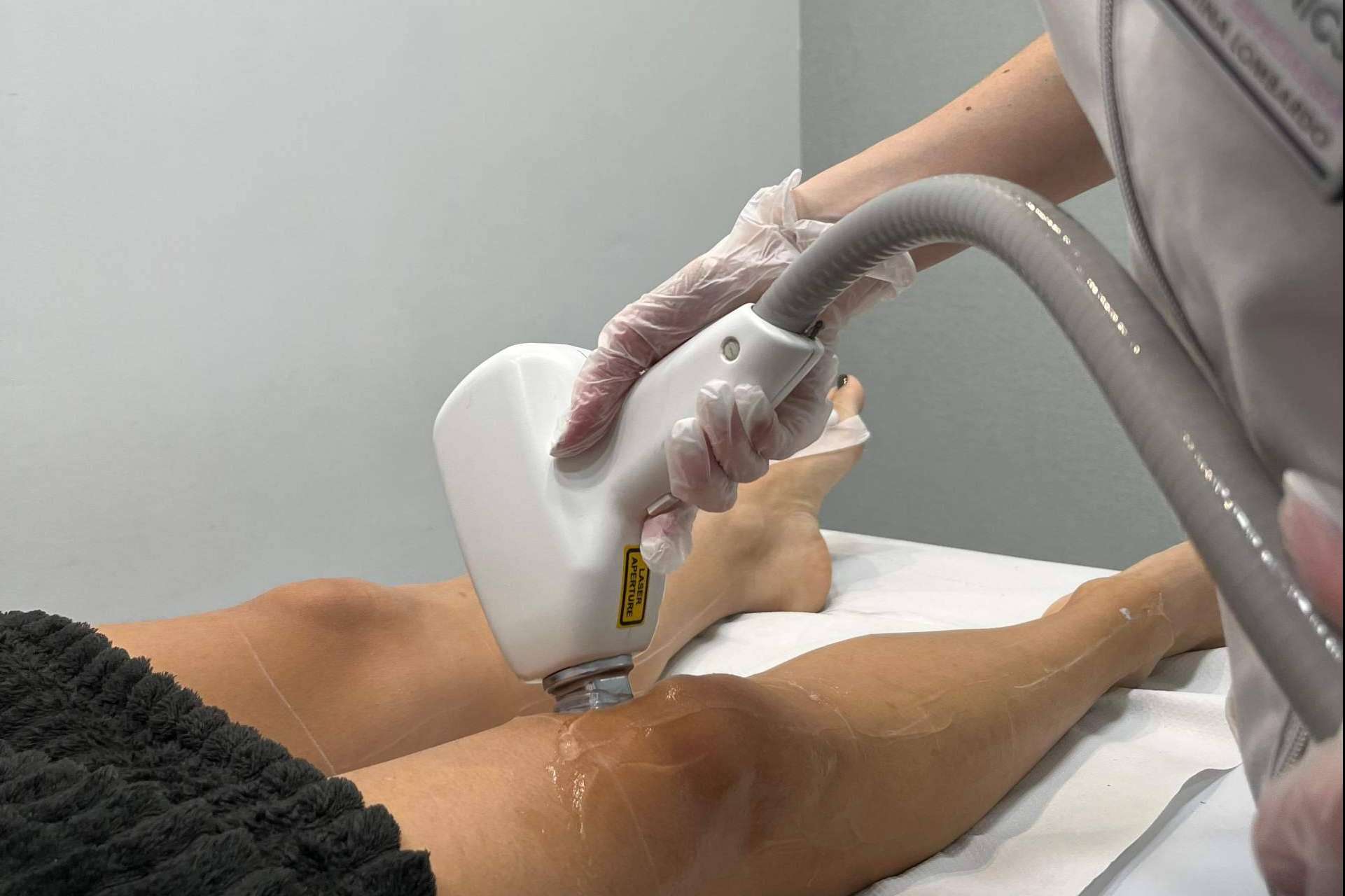 ¿Es seguro depilarse con láser en verano? 360Clinics responde con pautas esenciales