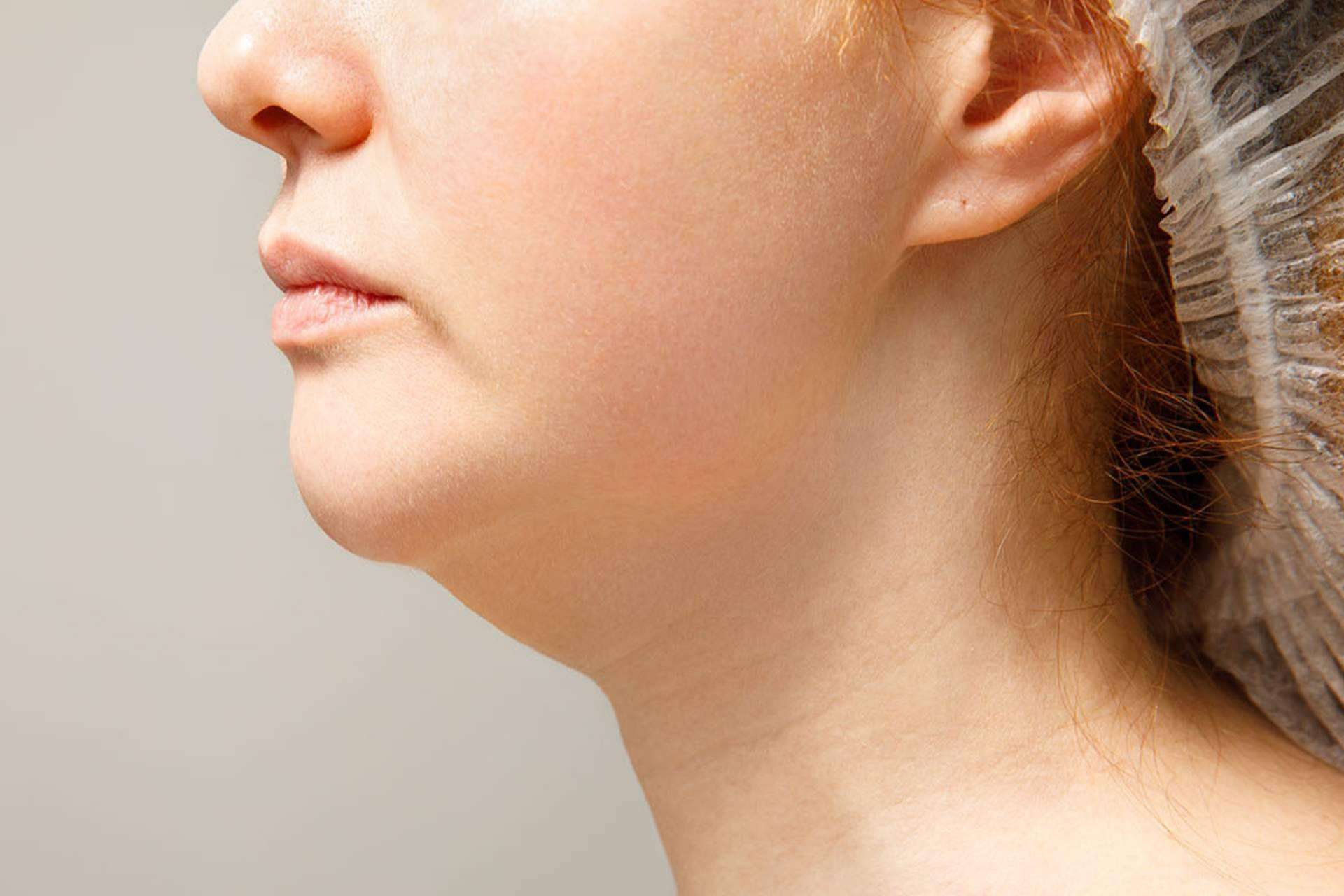 El secreto para un rostro más firme; Tratamientos efectivos para la papada