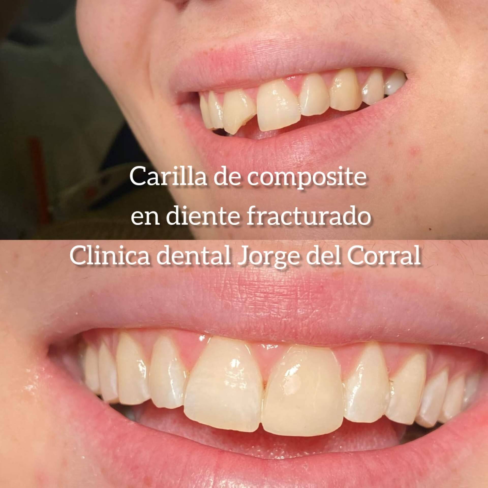 Jorge del Corral, la clínica dental que une calidad, precio y estética en Hortaleza