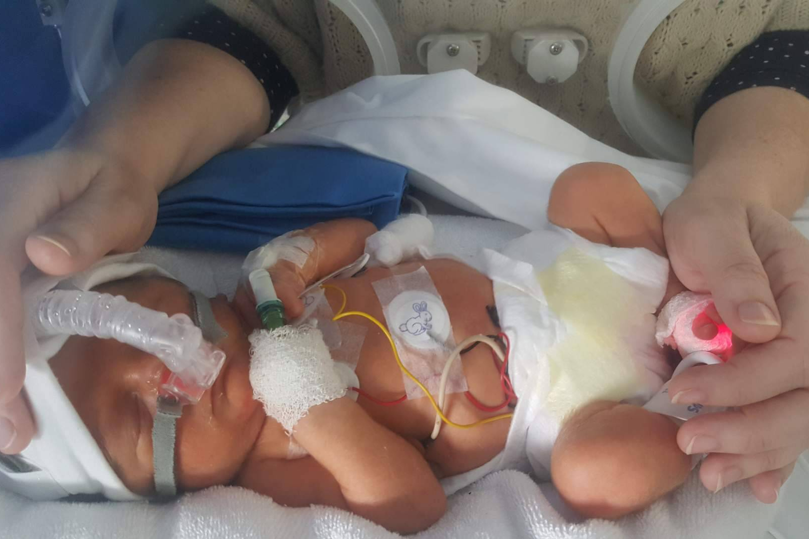 Día Mundial del Niño Prematuro; miles de familias españolas enfrentan retos que no se ven