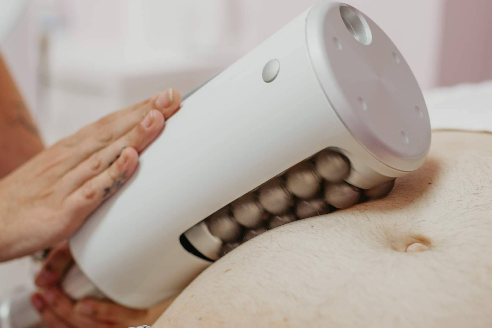 Láser verde, ondas de choque y Endosphères Therapy; innovación estética en Star Wappas